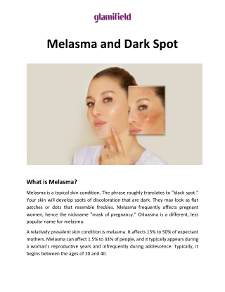 Melasma and Dark Spot