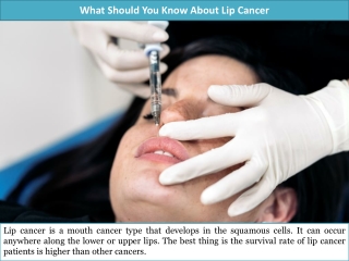 What Should You Know About Lip Cancer?