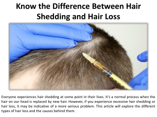 What is the difference between hair shedding and hair loss?