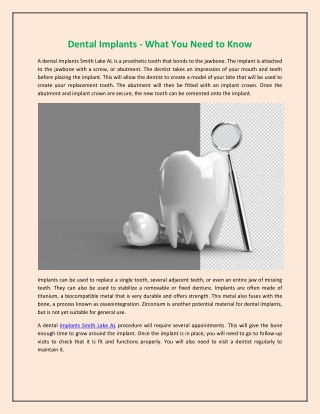 Dental Implants - What You Need to Know