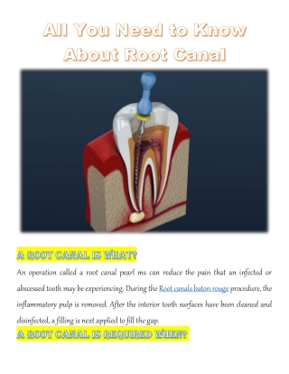 All You Need to Know About Root Canal