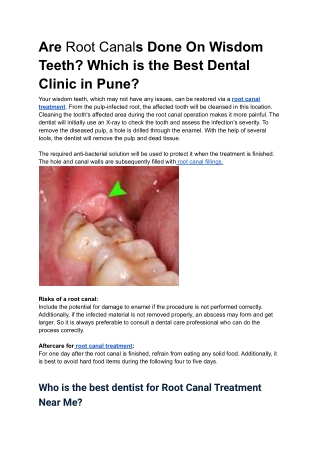 Are Root Canals Done On Wisdom Teeth