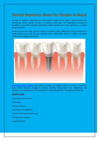 Dental Implants: Boon for People in Need