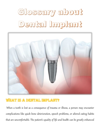 Glossary about Dental Implant