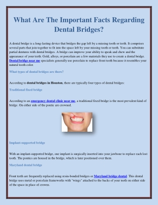 What Are The Important Facts Regarding Dental Bridges?