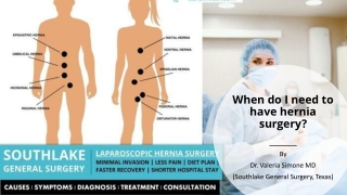 When do I need to have hernia surgery