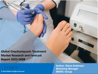 Onychomycosis Treatment Market Research and Forecast Report 2023-2028