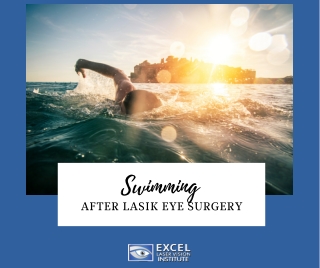 Swimming After LASIK