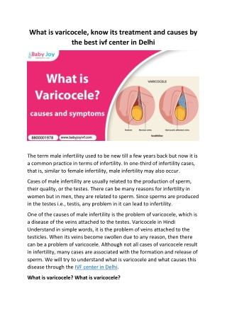 What is varicocele know its treatment and causes by the best IVF center in Delhi