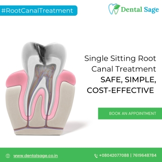 Single Sitting Root Canal Treatment | Dental Clinic in Yelahanka | Dental Sage