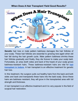 When Does A Hair Transplant Yield Good Results_.docx