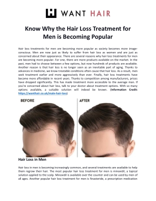 Know Why the Hair Loss Treatment for Men is Becoming Popular