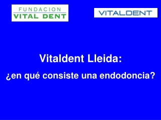 Vitaldent Lleida explica en que consiste una endodoncia