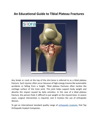 An Educational Guide to Tibial Plateau Fractures.docx