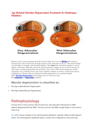 Age Related Macular Degeneration Treatment In Ghatkopar, Mumbai