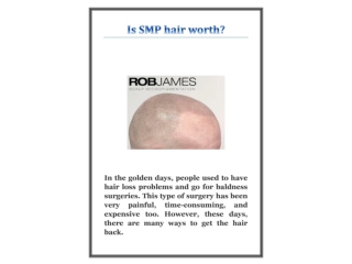 Is SMP hair worth