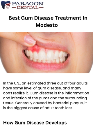 _Best Gum Disease Treatment In Modesto