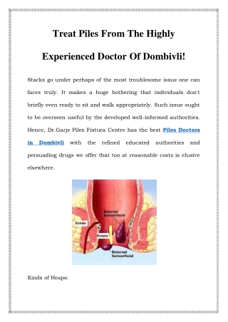 Piles Doctors in Dombivli Call-8767492935