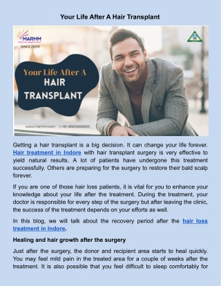 Your Life After A Hair Transplant