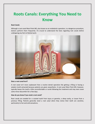 Roots Canals - Everything You Need to Know