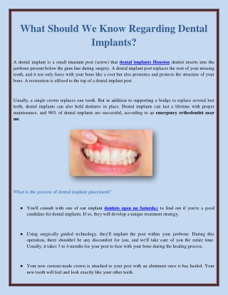 What Should We Know Regarding Dental Implants?