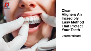 Clear Aligners An Incredibly Easy Method That Protect Your Teeth