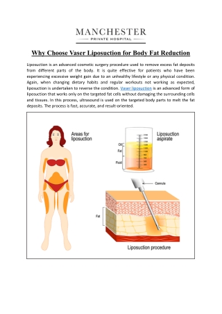Why Choose Vaser Liposuction for Body Fat Reduction