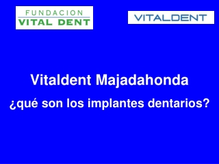 Los implantes dentales en Vitaldent Majadahonda