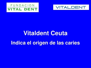 Vitaldent Ceuta indica el origen de las caries