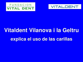 Vitaldent Vilanova i la Geltru explica el uso de las carilla