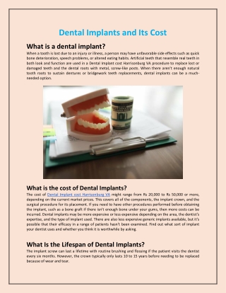 Dental Implants and Its Cost