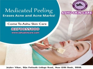 ashu skin care is best for medicated peeling treatment clinic in bhubaneswar, odisha