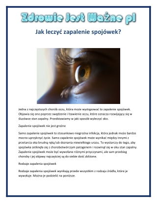 Jak leczyć zapalenie spojówek?