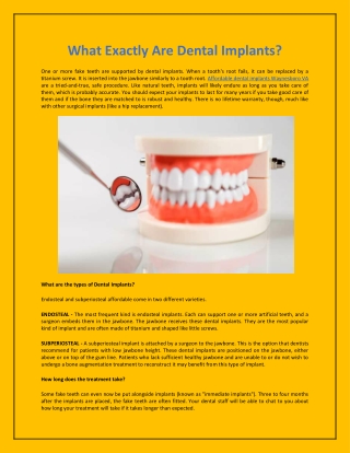 What Exactly Are Dental Implants?