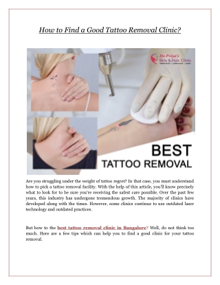 How to Find a Good Tattoo Removal Clinic?