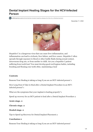 indibloghub.com-Dental Implant Healing Stages for the HCV-Infected Person