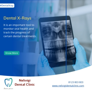 Dental X Rays | Best Dental Clinic in Bellandur, Bangalore | Nelivigi Dental