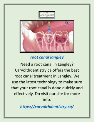 Root Canal Langley | Carvolthdentistry.ca