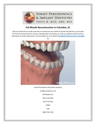 Full Mouth Reconstruction in Columbia, SC