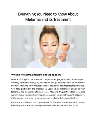 Everything You Need to Know About Melasma and its Treatment