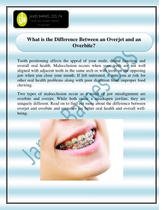 What is the Difference Between an Overjet and an Overbite