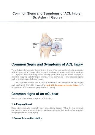 Common Signs and Symptoms of ACL Injury
