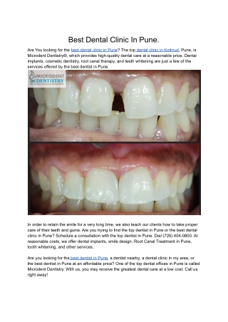 Best Dental Clinic In Pune