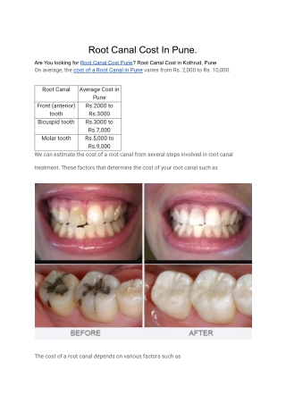 Root Canal Cost In Pune