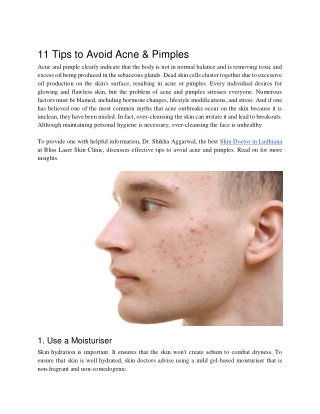 11 Tips to Avoid Acne & Pimples