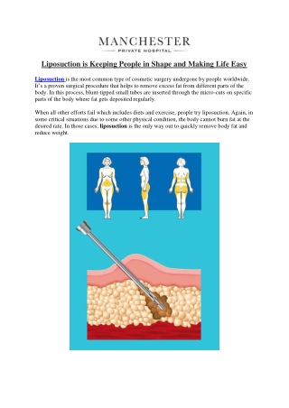 Liposuction is Keeping People in Shape and Making Life Easy
