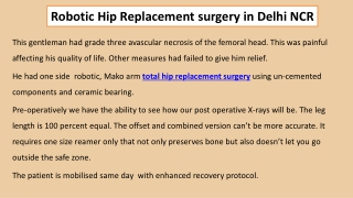 Robotic Hip Replacement surgery in Delhi NCR