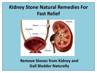 Kidney Stone Natural Remedies For Fast Relief