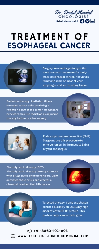 Treatment of Esophageal Cancer