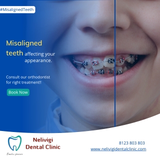 Misaligned teeth Problems | Best Dental Clinic in Bellandur | Nelivigi Dental